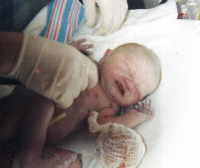 Cody at birth